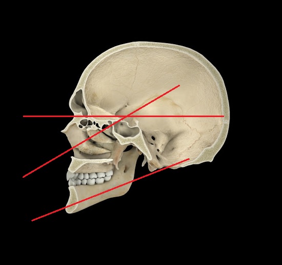 skull